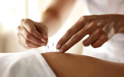 L’acupuncture à Reims